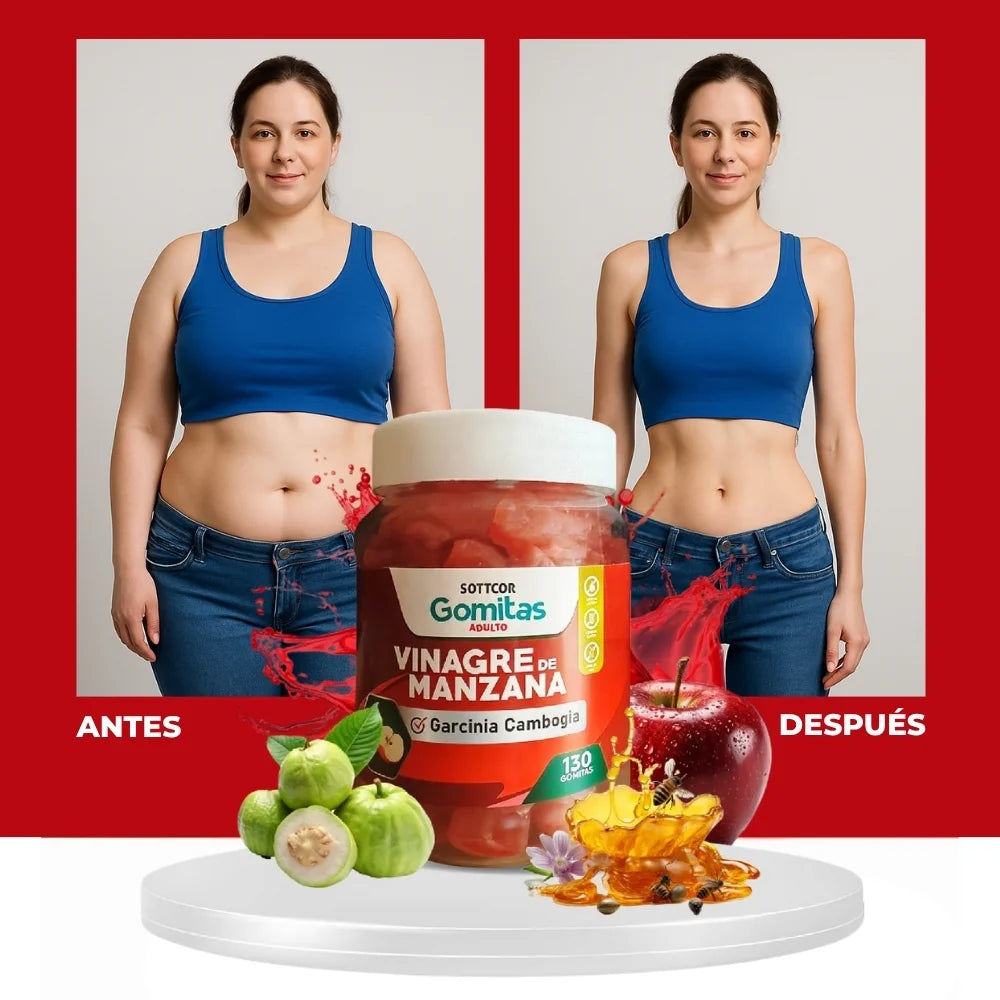 Gomitas vinagre de manzana